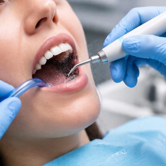 dental cleaning